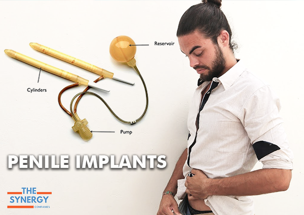 Penile implants